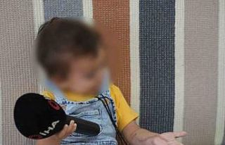 Iğdır’da 1,5 yaşındaki çocuğun tomografi sonrası...