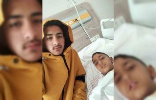 Ankara’da sokak köpeğinin saldırısına uğrayan...