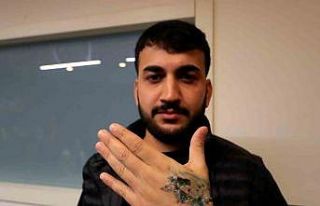 Dövme sildirmek isterken kabusu yaşadı, elindeki...