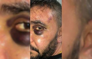 İsyeri sahibi dükkanında öldüresiye darp edildi