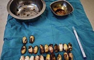 Midesinde taşıdığı uyuşturucu maddeler polisin...