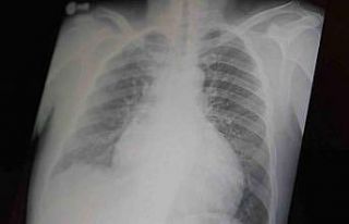 Profesör açıkladı: "Metamfetamin ve kokain...