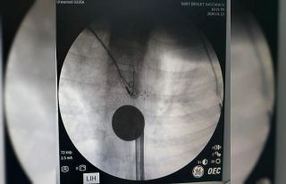 Siirt’te boğazına madeni para kaçan çocuk, doktorların...