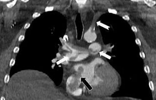 Tekden’de başarılı çalışmalara imza atan radyoloji...