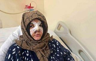 Kocasının öldüresiye darp ettiği kadın dehşet...