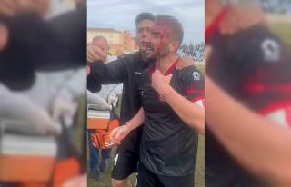 Maç sonu saha karıştı: 3 futbolcu yaralandı