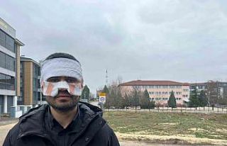 Rehber öğretmenin yüzüne sıcak çay fırlattığı...