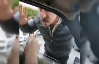 Ailesinin yanında saldırıya uğradı: Olayın faturası...