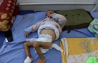 Gazzeli çocuklar ateşkesin gölgesinde açlıkla...