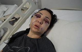 Oğlunun gözü önünde anneyi öldüresiye dövdüler:...