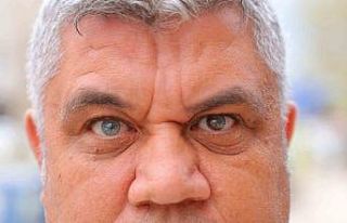 Kahramanmaraşlı adam 3 renkli gözleriyle görenlerin...