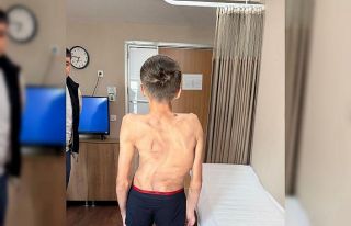 Kırgızistanlı genç şifayı Türk hekimlerinde...