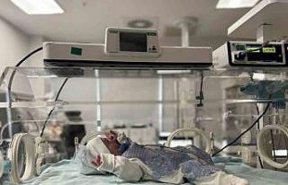 Mardin’de nadir görülen hastalıkla doğan bebek...