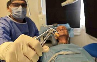 83 yaşında 20’lik dişi çıktı