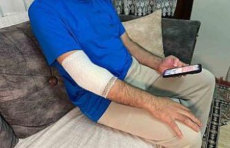 Başakşehir’de sitenin güvenlik görevlisine sahipli köpek saldırdı