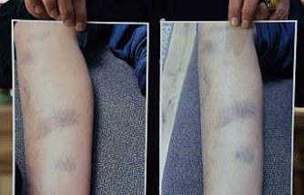 Diyarbakır’da özel okulda 8 yaşındaki çocuğun darbedildiği iddiası