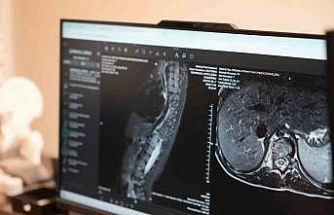 Sinsi ilerleyen bu rahatsızlığı ilk fark eden anneler oluyor