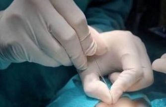 Çukurca’da gözyaşı kanalı ameliyatları yapılmaya başlandı