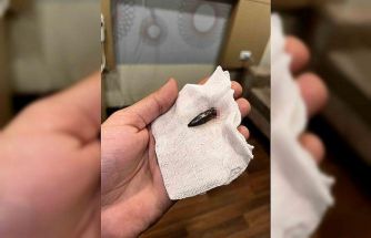 Gazzeli Awad, 1,5 yıldır kafasında taşıdığı mermiden Türk yardımseverlerin desteğiyle kurtuldu