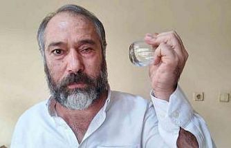 ‘Küfürlü konuşmayın’ diye uyardı, gözünden oldu