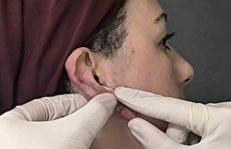 Muş’ta bir ilk: Kulak keloidi, ödüllü cerrahi teknikle tedavi edildi