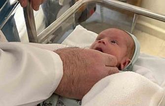 Anne karnındayken milyonda bir görülecek sağlık sorunuyla doğdu