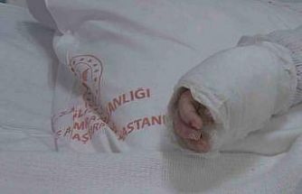 Üzerine kaynar su dökülen bebeğin vücudunun yüzde 27’si yandı