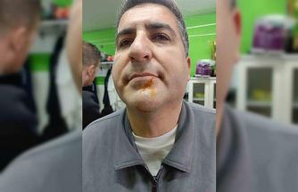 Zonguldak’ta 3. Lig maçı sonrası gerginlik: 2 gazeteci darbedildi, 2 polis yaralandı