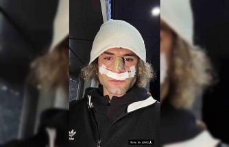 Elazığspor’da Fuat Bavuk’un burnu kırıldı