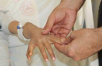 Şırnak’ta yapışık parmaklı iki kardeş ameliyatla sağlıklarına kavuştu