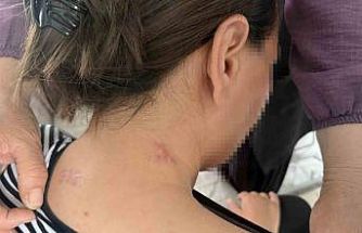 17 bıçak darbesi aldı, ölü numarasıyla kurtuldu, kocasının en ağır cezayı almasını istedi