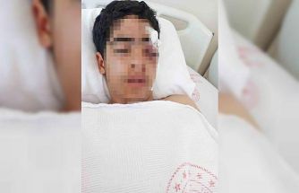 Akran zorbalığına bir yenisi eklendi: 15 yaşındaki çocuk muştayla öldüresiye dövüldü