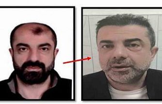 Ameliyat ile yüzünü değiştiren firari cinayet zanlısı, 7 yıl sonra yakalandı