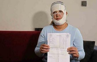 Güzelleşmek uğruna gittiği merkezde yüzü yandı