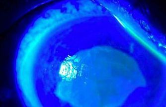 ’Kırlangıç otu kullanımı’na dikkat, uzmanlar uyarıyor: "Gözlerine suyunu damlattı, göremez hale geldi"