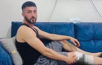 Nizip’te başıboş köpek saldırısında yaralanan 2 kişi belediyeye tepki gösterdi