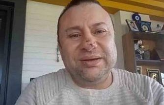 Pitbull saldırısına uğrayan Onur Akay o anları anlattı: "Ben ölümden döndüm"