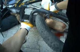 Osmaniye’de ayağı bisikletin tekerine sıkışan çocuk ekiplerce kurtarıldı