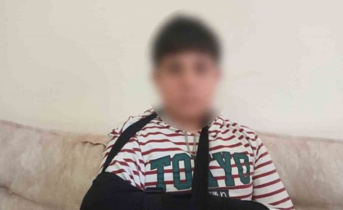 Ankara’da ortaokul öğrencisi, kendisinden 3 yaş küçük öğrencinin parmağını kırdı