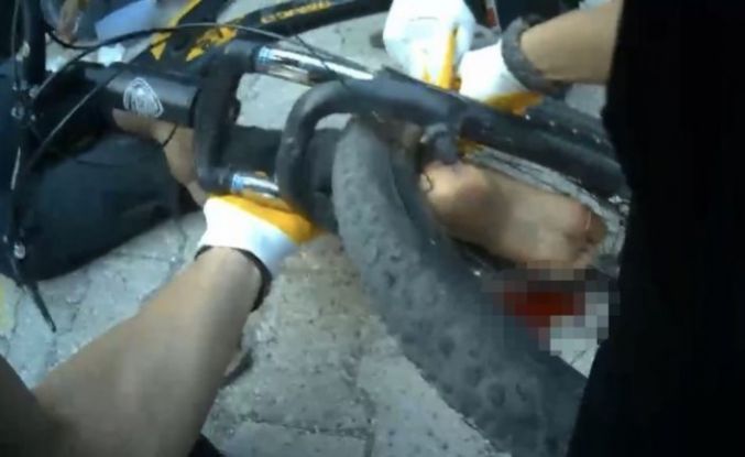 Osmaniye’de ayağı bisikletin tekerine sıkışan çocuk ekiplerce kurtarıldı