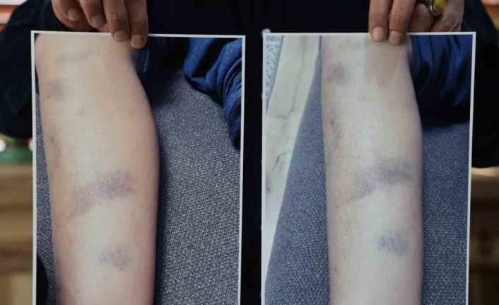 Diyarbakır’da özel okulda 8 yaşındaki çocuğun darbedildiği iddiası