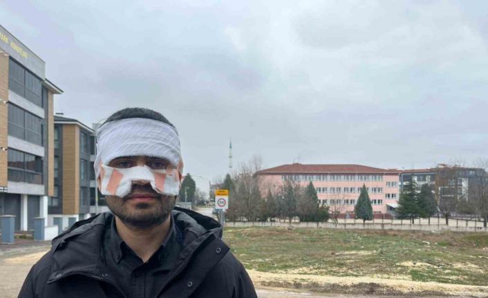 Rehber öğretmenin yüzüne sıcak çay fırlattığı fizik öğretmeni feci şekilde yandı