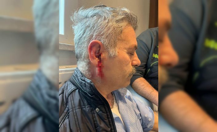 Silivri’de özel bakım merkezine çağrılan eski çalışan darbedildi