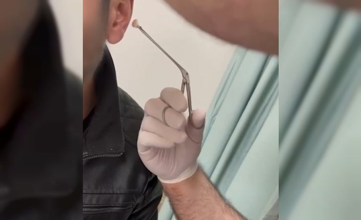 Kayseri’de kulağının içine uyuşturucu saklayan şüpheli yakalandı